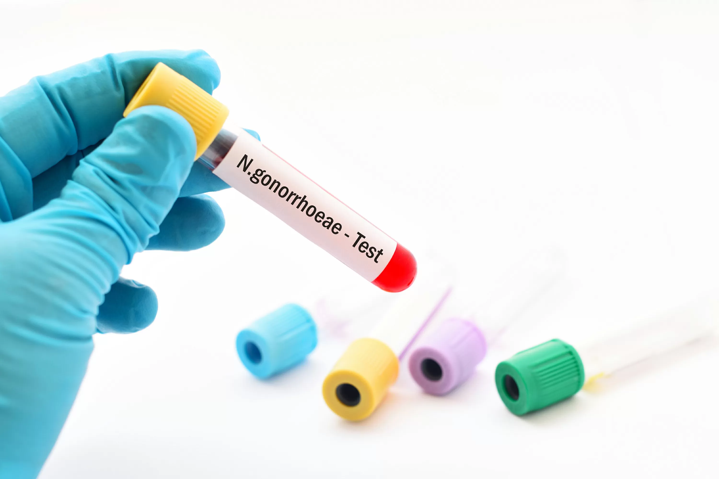Novo antibiótico contra gonorreia é aprovado após décadas sem inovações