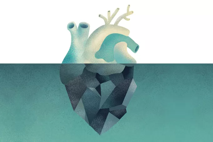 Fibrilação atrial: a arritmia silenciosa que prepara o terreno para o AVC