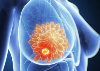 Coalizão cria plataforma para melhorar cuidado de paciente com câncer de mama