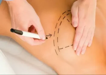 Próteses de silicone: é preciso trocá-las de tempos em tempos?