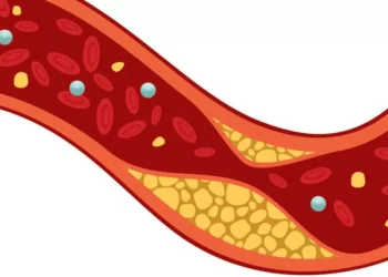 Colesterol ainda não é visto como risco para doenças cardiovasculares