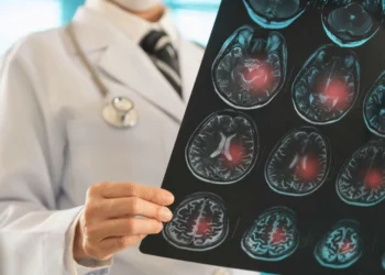 AVC mata um brasileiro a cada seis minutos; 80% dos casos poderiam ser evitados