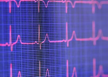 O pulso ainda pulsa… para alguns, infelizmente, não mais