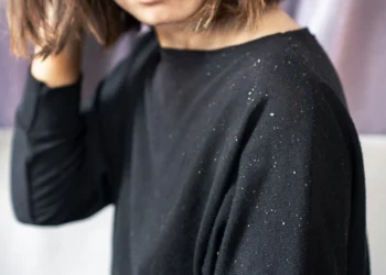 Caspa pode ser diferente em homens e mulheres: o que muda no tratamento?