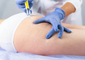 Novo procedimento estético usa gordura de pessoas falecidas como preenchimento